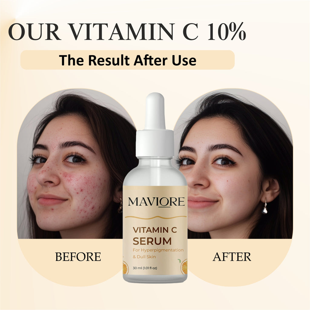 Maviore Vitamin C Serum for Hyperpigmentation & Dull Skin, 30ml
