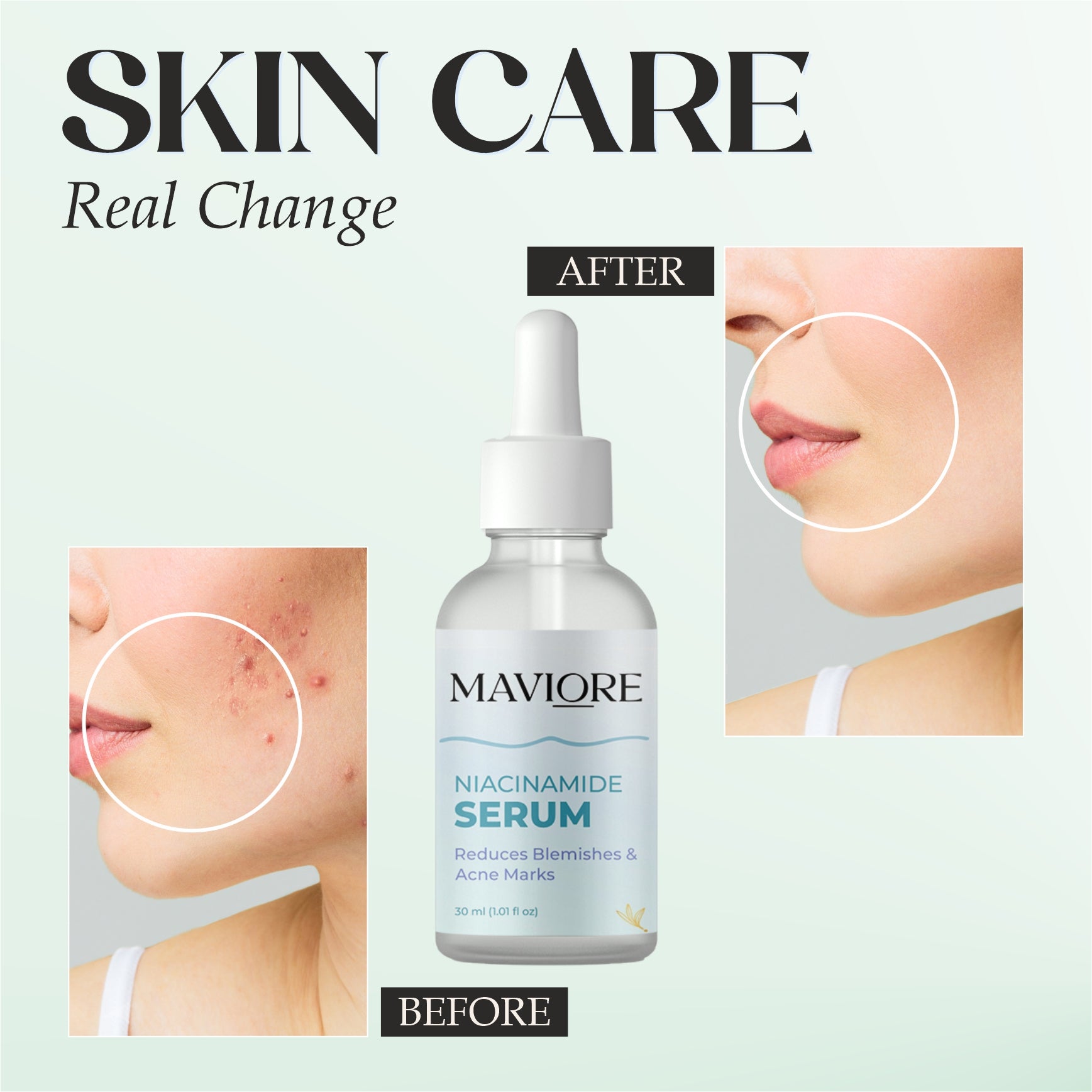 Maviore Niacinamide Serum, Reduces Blemishes & Acne Marks, 30 ml