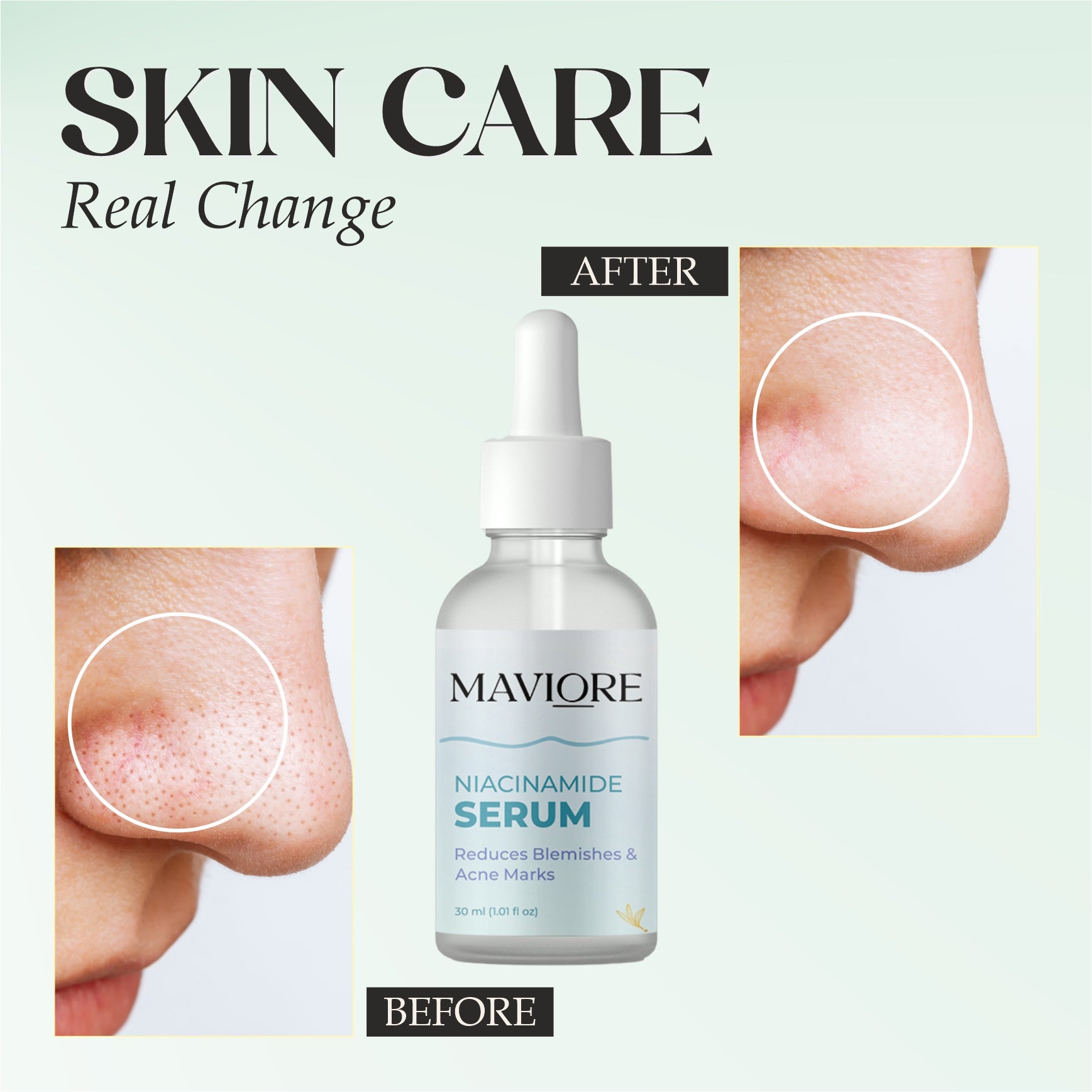 Maviore Niacinamide Serum, Reduces Blemishes & Acne Marks, 30 ml