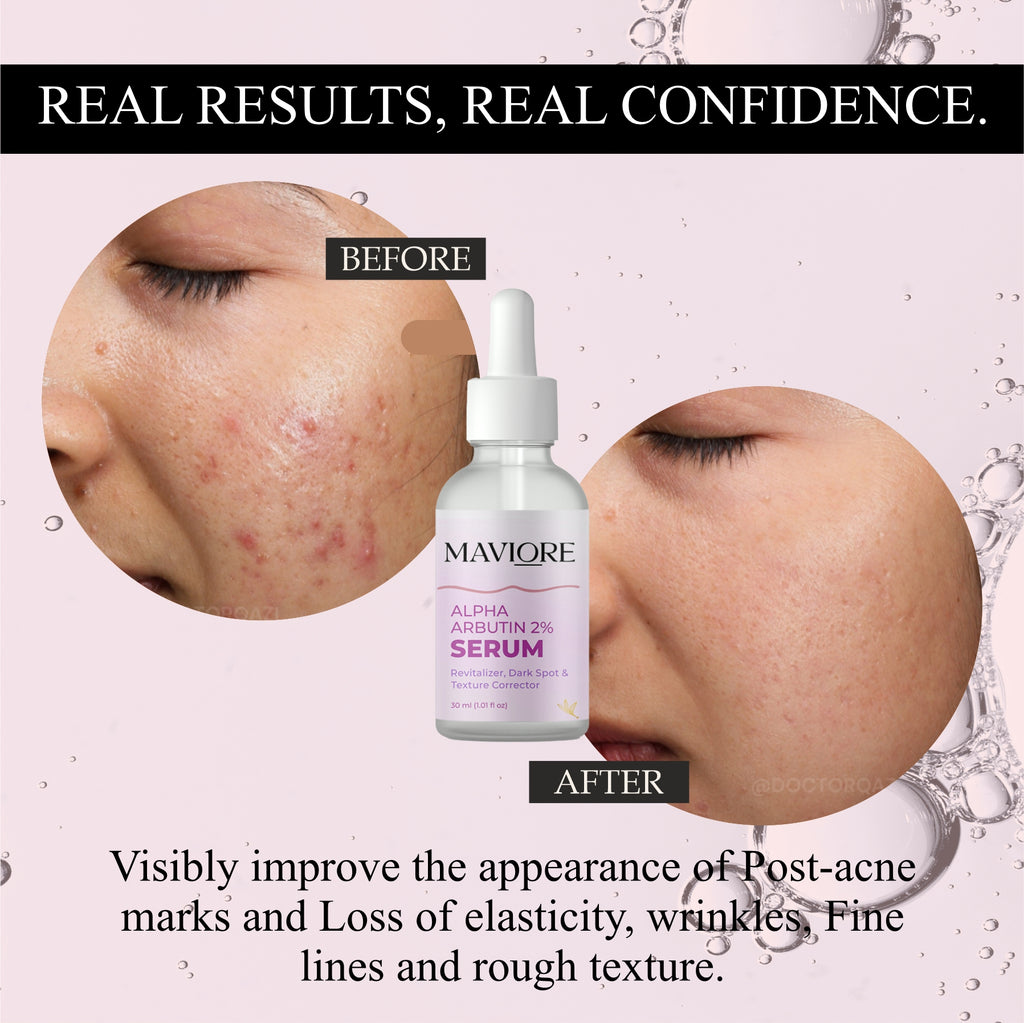 Maviore Alpha Arbutin 2% Serum, Revitalizer Dark Spot & Texture Corrector, 30ml