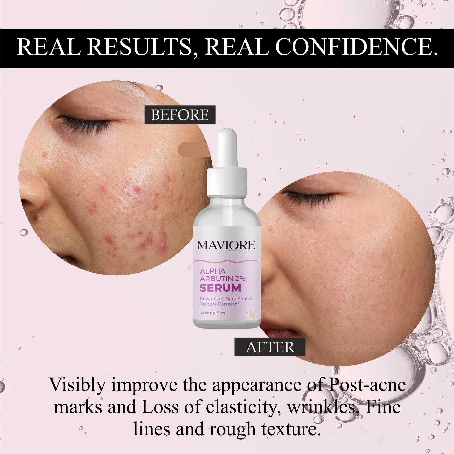 Maviore Alpha Arbutin 2% Serum, Revitalizer Dark Spot & Texture Corrector, 30ml