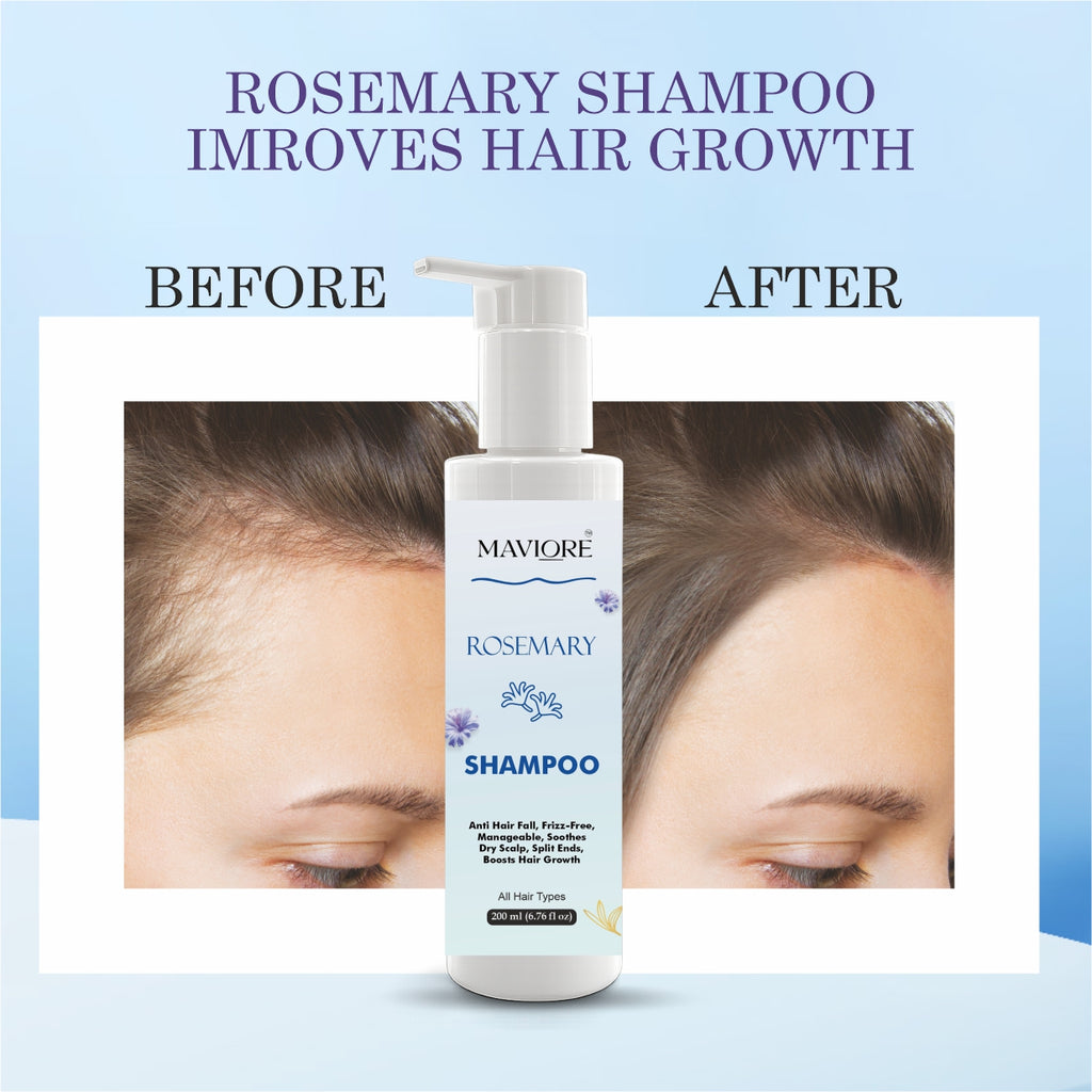 MAVIORE Rosemary Shampoo, Anti Hair Fall, Frizz-Free, Boosts Hair Growth, All Hair Types, 200 ml